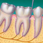  Gengivas saudáveis - as gengivas saudáveis são firmes e não sangram. Aderem à volta dos dentes.