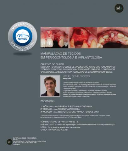 Manipulação de Tecidos em Periodontologia e Implantologia