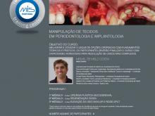 Manipulação de Tecidos em Periodontologia e Implantologia